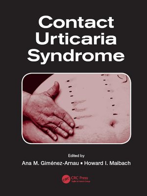 cover image of Contact Urticaria Syndrome